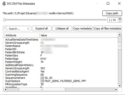 Capture d'écran de la fenêtre "Metadata" du logiciel Slicer