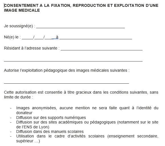 Extrait de la déclaration de consentement que le patient doit remplir